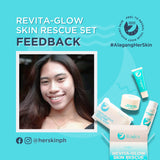 "Revive and Radiate: Her Skin Revita Glow - The Ultimate 14-Day Solution for Age-Defying, Acne-Preventing, and Hydrating Skin"