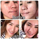 Brilliant Rejuvenating facial set