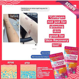 Pure Beauty Collagen Powder – Premium Japanese Collagen