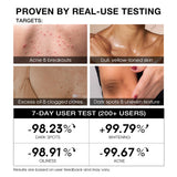 TeaShell Niacinamide Skin Brightening Soap 100g - Alpha-Arbutin, Tranexamic Acid, Glutathione &

377