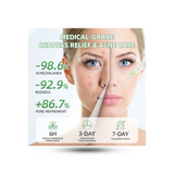Teashell Acne Clearing & Oil-Control Serum Ampoules – AHA + PHA + BHA, 1.5ml x 5