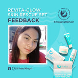 "Revive and Radiate: Her Skin Revita Glow - The Ultimate 14-Day Solution for Age-Defying, Acne-Preventing, and Hydrating Skin"