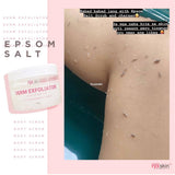 RyxSkin Derm Exfoliator - Epsom Salt Scrub 250g